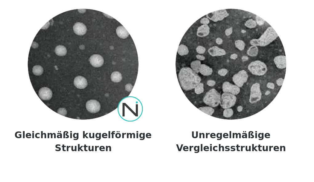 TEM-Vergleich gleichmäßig kugelförmiger und unregelmäßiger liposomaler Strukturen